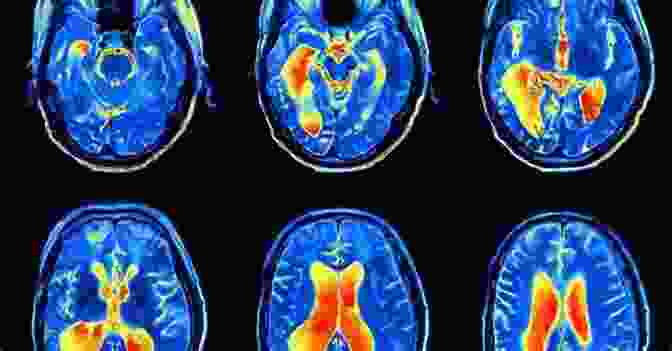 An MRI Scan Showing Brain Activity During Memory Encoding. The Art Of Memory: An Ethnographer S Journey (Historia Y Ciencias Sociales)