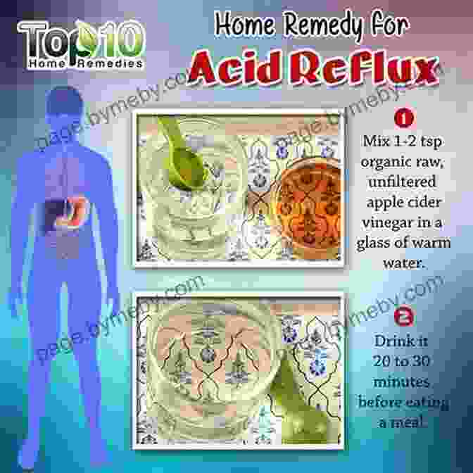 Natural Supplements That Support Acid Reflux Relief Heartburn Cures Handbook: Easy Fast Acid Reflux Relief Using Natural Remedies And Treatments